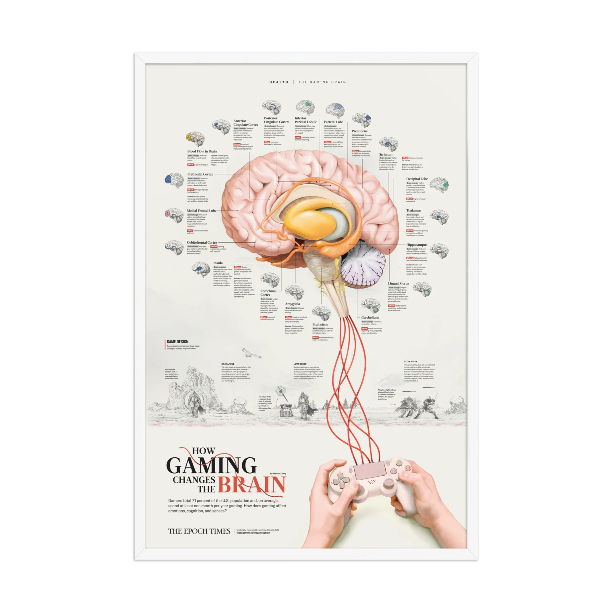 How Gaming Changes the Brain - Image 3